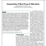 Interpretation of Chest X-rays in Tuberculosis | Lets Talk TB